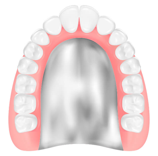 金属床義歯（チタン、コバルトクロム）